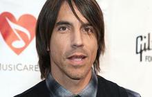 Pasca operasi, vokalis RHCP pamer mobil aneh