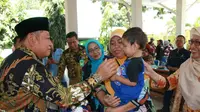 Pemkab Sidoarjo Bakal Bantu Pengobatan Balita Sakit Omfalokel