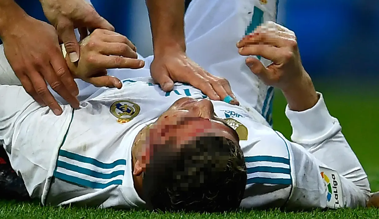 Cristiano Ronaldo terlihat kesakitan setelah mencetak gol ke gawang Deportivo de la Coruna pada lanjutan La Liga Spanyol di stadion Santiago Bernabeu di Madrid (21/1). insiden terjadi saat Ronaldo mencetak gol keduanya. (AFP Photo/Oscaro Del Pozo)