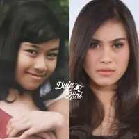 Tampilan Syahnaz Sadiqah dulu dan kini. (Istimewa)