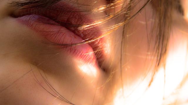 Punya Bibir Gelap? Ini Bahan Alami yang Dapat Mencerahkannya