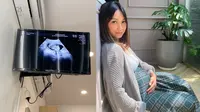 Momen Haru Nola B3 Umumkan Kehamilan Anak Keempat, Penuh Suka Cita. (Sumber: Instagram/riafinola)