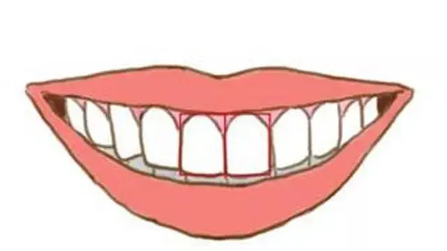 Ilustrasi gigi depan