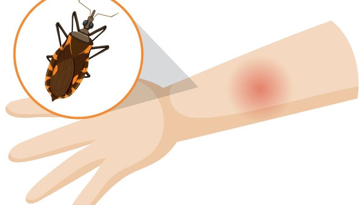 Ketahui Bahan-Bahan Rumahan yang Ampuh Jadi Pengusir Nyamuk, Efektif dan Praktis