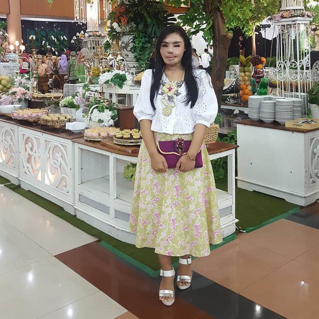 6 Potret Terbaru Lisa, Korban Penyiraman Air Keras Kini Jadi Pengusaha Perhiasan