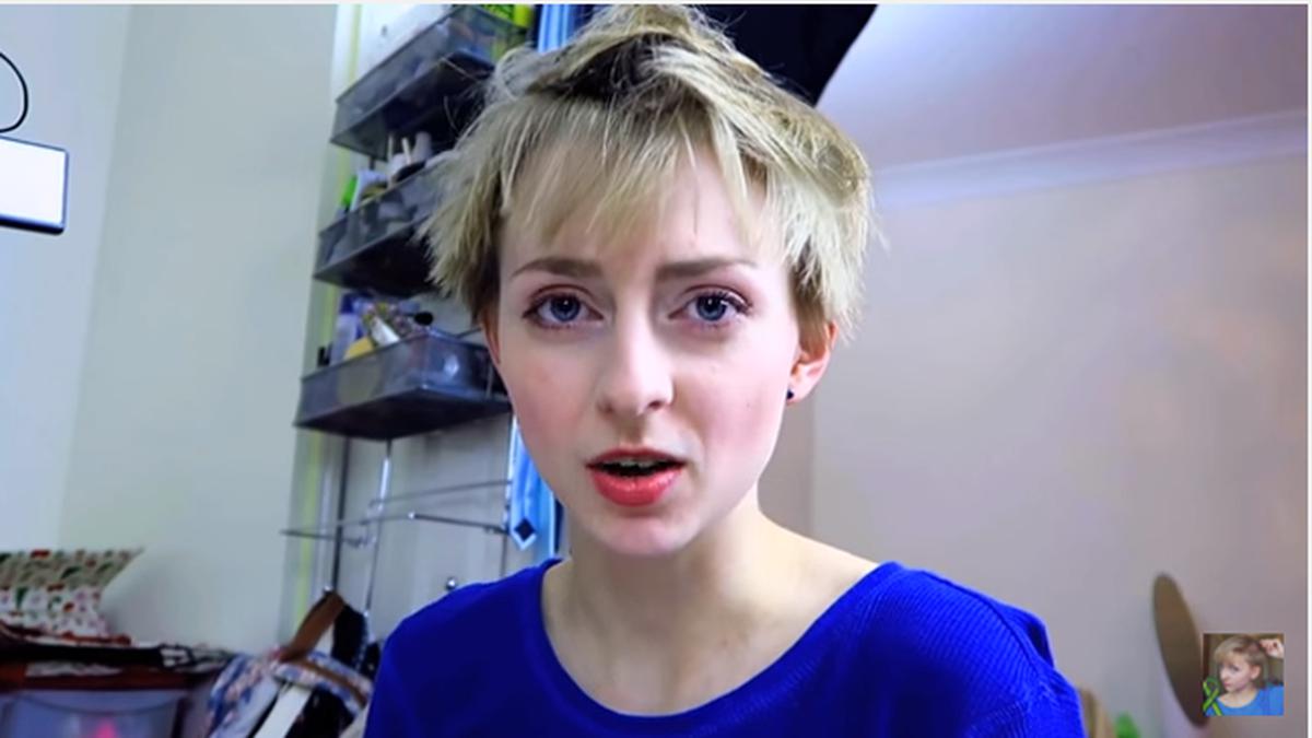 Punya Kebiasaan Cabuti Rambut, Perempuan Ini Gunduli Kepala