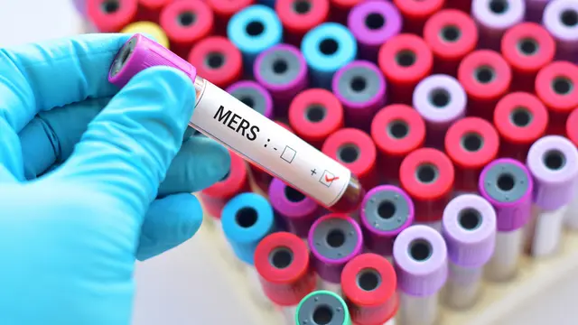 Berkenalan dengan Flu Unta alias MERS (Jarun Ontakrai/shutterstock)