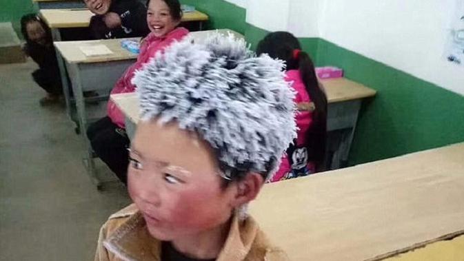 Rambut bocah asal China jadi bahan tertawaan oleh teman sekelas karena tampak keras dan membeku oleh es (People's Daily Online)