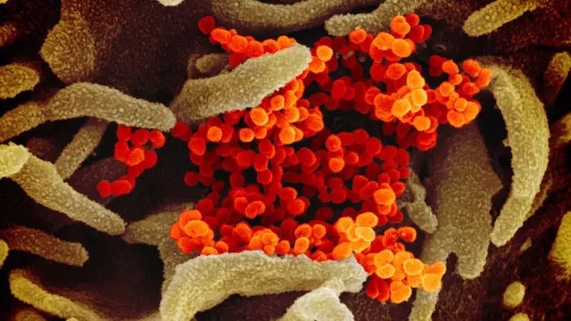 Virus Corona COVID-19 dari Mikroskop