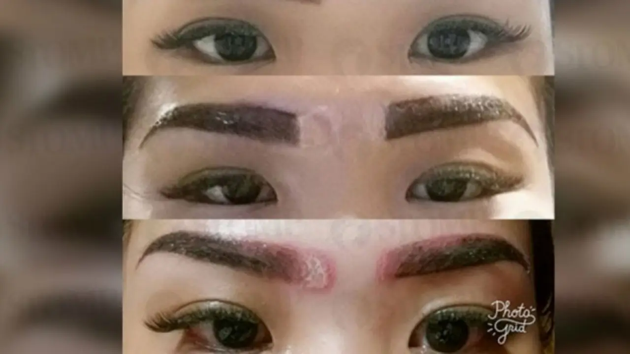 [Bintang] Gara-gara Sulam Alis, Cewek Ini Mengalami Hal yang Mengerikan
