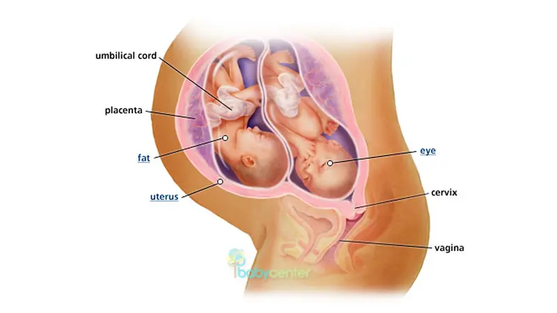 bayi-kembar-130906b.jpg