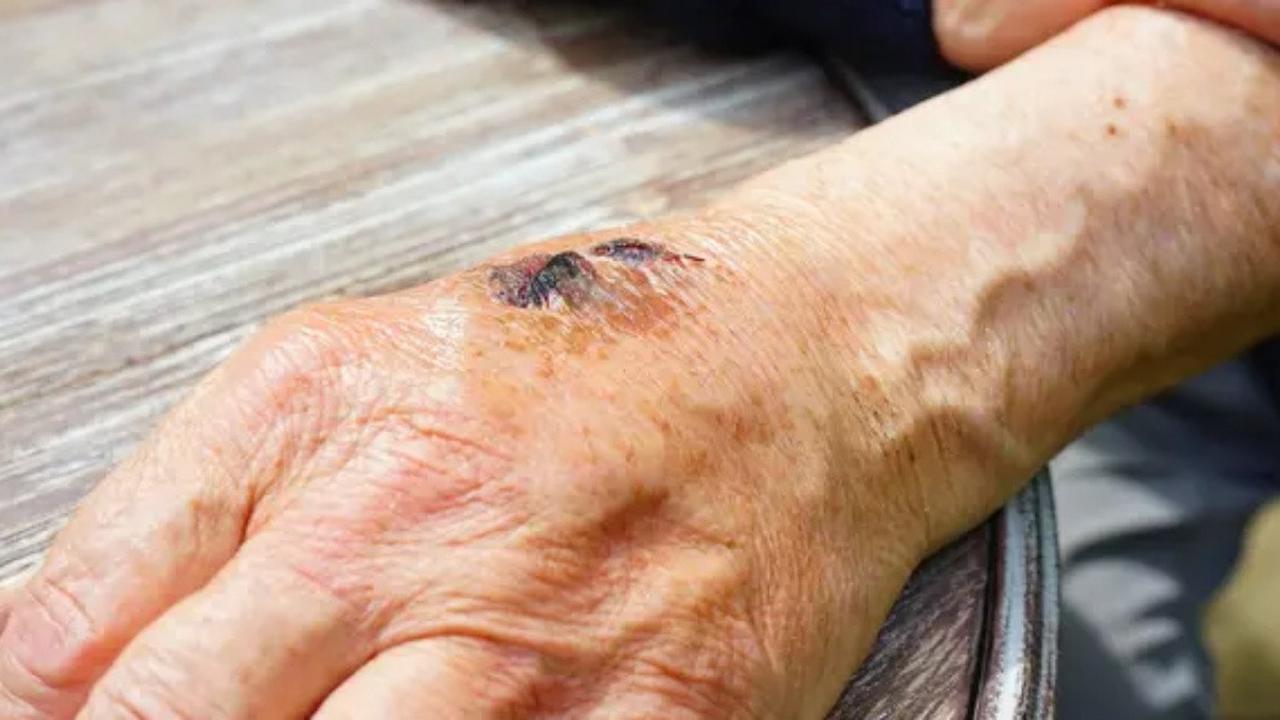 7 Efek Gigitan Ular Weling yang Wajib Diwaspadai, Ketahui untuk Penanganan Terbaik
