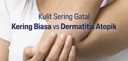 Beda kulit kering biasa dengan eksim. (Cetapil)