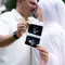 Irish Bella Umumkan Kehamilan Pertama dengan Haldy Sabri, Tampil Modest Bernuansa Pastel