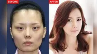 Terobsesi Jadi Model, Wanita Ini Permak Wajahnya