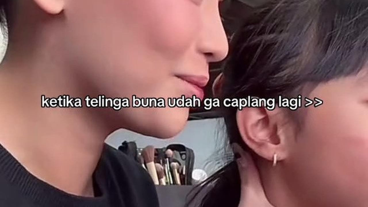 Rachel Vennya Perlihatkan Kuping Baru, Akui Merasa Bahagia Tak Caplang Lagi: Mungkin Pas Lagi 'di Pabrik' Lupa Dijahit