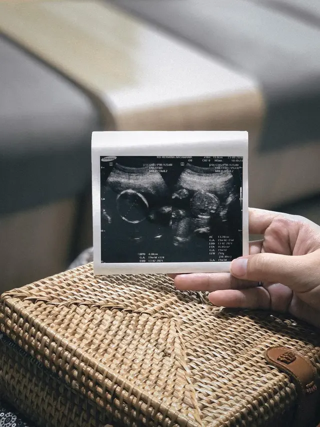 Potret perjalanan kehamilan Aqia Nurfadla, istri Fiersa Besari. (Sumber: Instagram/fiersabesari dan Instagram/aqianr)