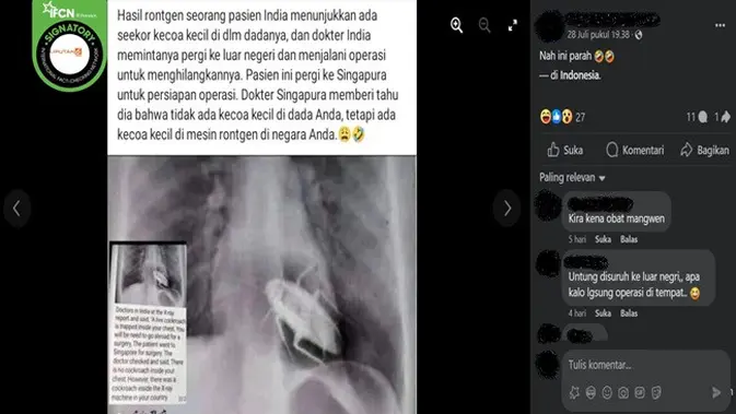 <p>Gambar tangkapan layar foto yang diklaim hasil rontgen pasien di India dan terdapat seekor kecoa di dalam dadanya. (sumber: Facebook)</p>