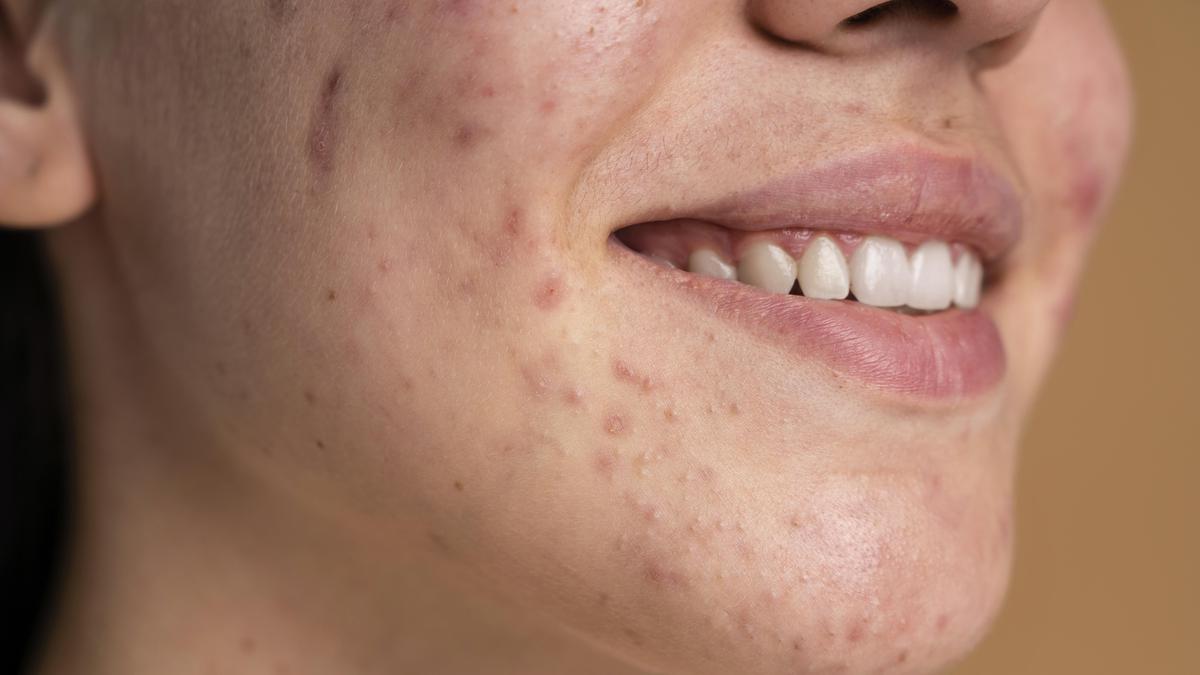 Cara Membuat Toner Alami untuk Mengecilkan Pori-pori Wajah