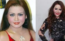 9 Transformasi Artis Sebelum dan Setelah Lakukan Face Lifting, Ada yang Berubah Drastis