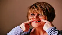 Pasien wanita kaget melihat dua giginya hilang setelah menjalani operasi pengangkatan rahim.