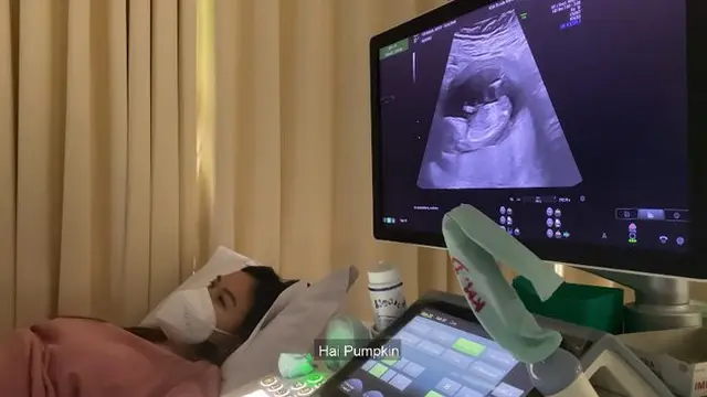 7 Momen Marcel Chandrawinata dan Istri Umumkan Kehamilan Pertama, Penuh Kebahagiaan