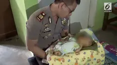 Sejak lahir bayi ini menderita luka bakar di beberapa bagian tubuhnya. Beberapa kali berobat, belum ada hasil yang signifikan.