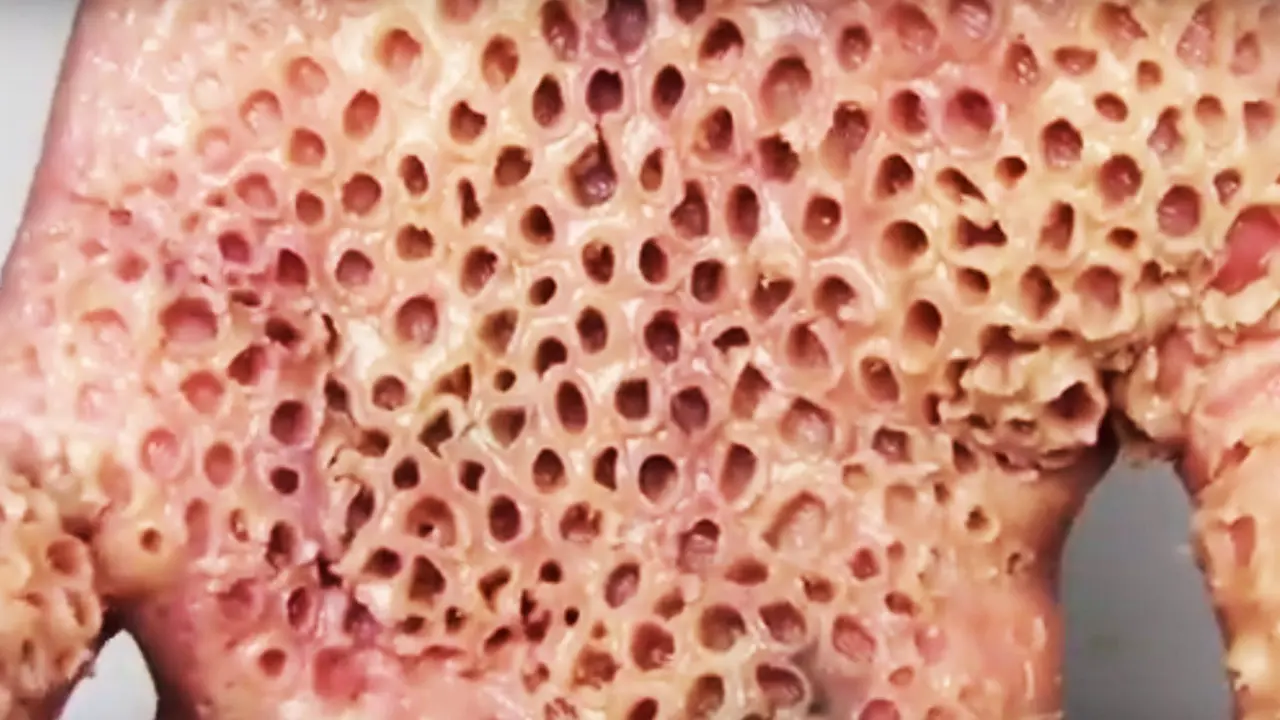 [Bintang] Jika Foto Ini Membuatmu Takut, Mungkin Kamu Terkena Trypophobia