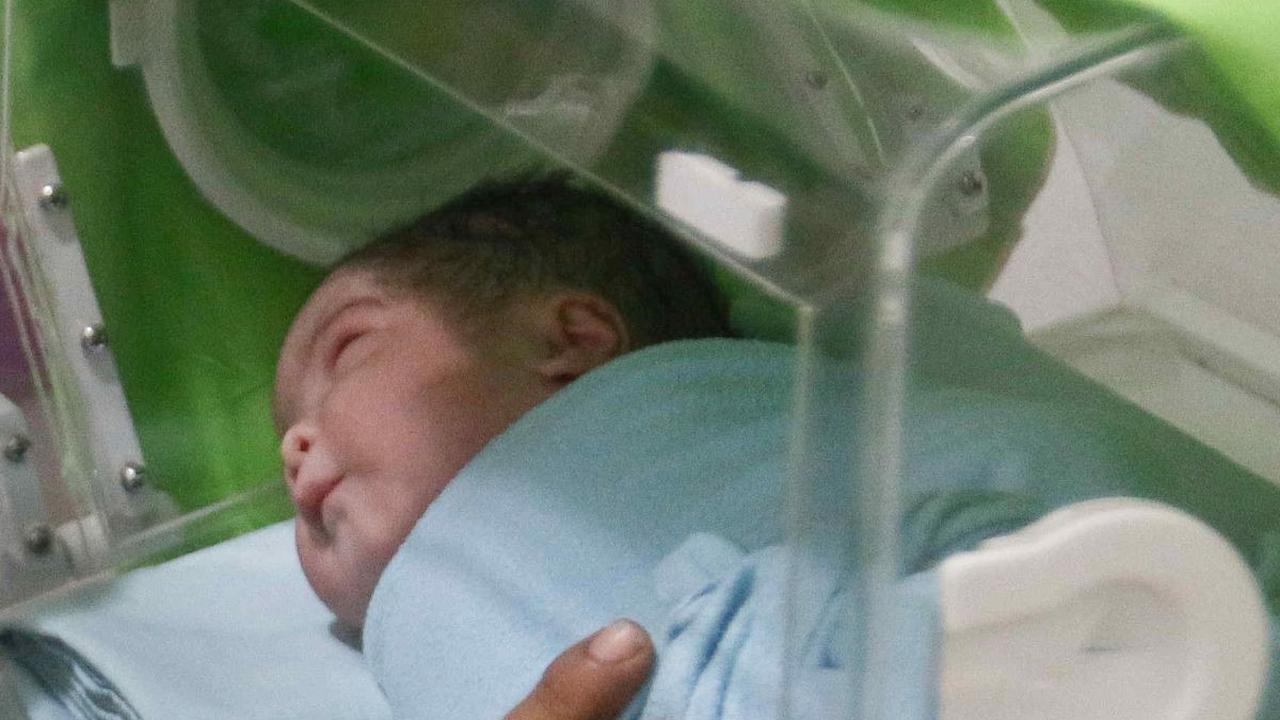 Kelahiran dua bayi tersebut dilakukan menggunakan metode caesar.&nbsp;Liputan6.com/Herman Zakharia&nbsp;