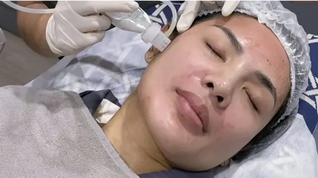 Nindy Ayunda Lakoni Rutinitas Perawatan Collaglow untuk Tampil Glowing Meski Tanpa Makeup