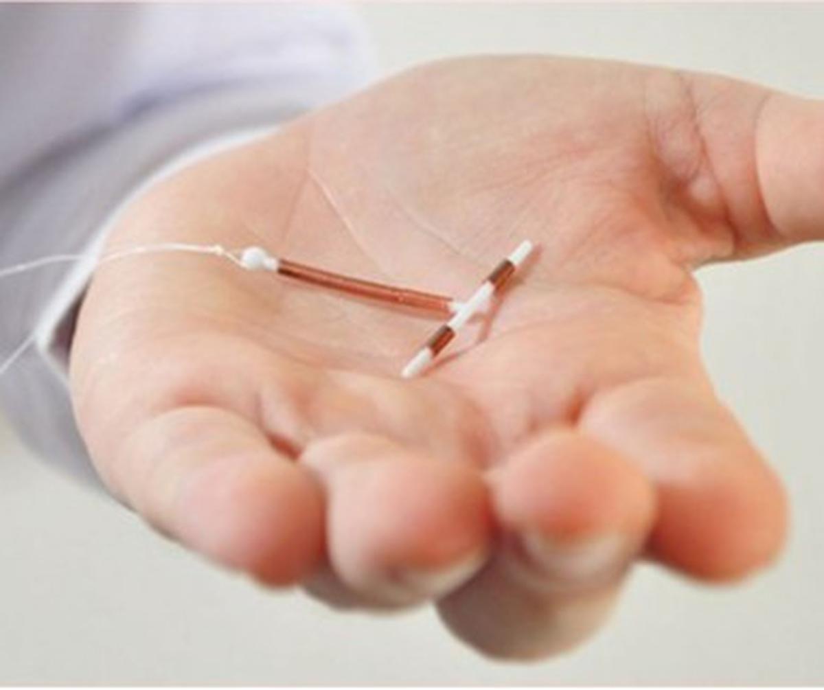 Jenis–jenis Kontrasepsi IUD