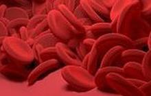 Kenali Kondisi Leukemia atau Kanker Darah yang Bisa Diderita oleh Anak