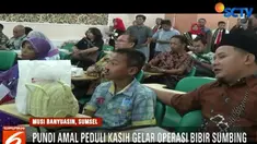 Bakti sosial digelar empat hari mulai tanggal 14 hingga17 Desember 2018 dan didukung dokter spesialis bedah mulut dan maksilofasial.