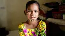 Sahana Khatun yang wajahnya ditumbuhi beberapa kutil menjalani perawatan di sebuah rumah sakit di Dhaka, Bangladesh, 30 Januari 2017. Mereka yang menderita penyakit tergolong langka di dunia ini disebut tengah menderita penyakit ganas. (STR/AFP)