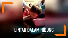 Gara-gara berenang di sungai, seorang bocah 7 tahun mengalami nasib miris. Seekor lintah masuk dan bersarang di hidungnya.