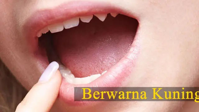 Foto: copyright thinkstockphotos.com