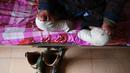 Penderita kusta duduk di ranjang kompleks RS Van Mon Leprosy, Thai Binh, Vietnam, Minggu (20/1). RS Van Mon Leprosy pernah menangani hingga 4.000 pasien dalam setahun. (Manan Vatsyayana/AFP)