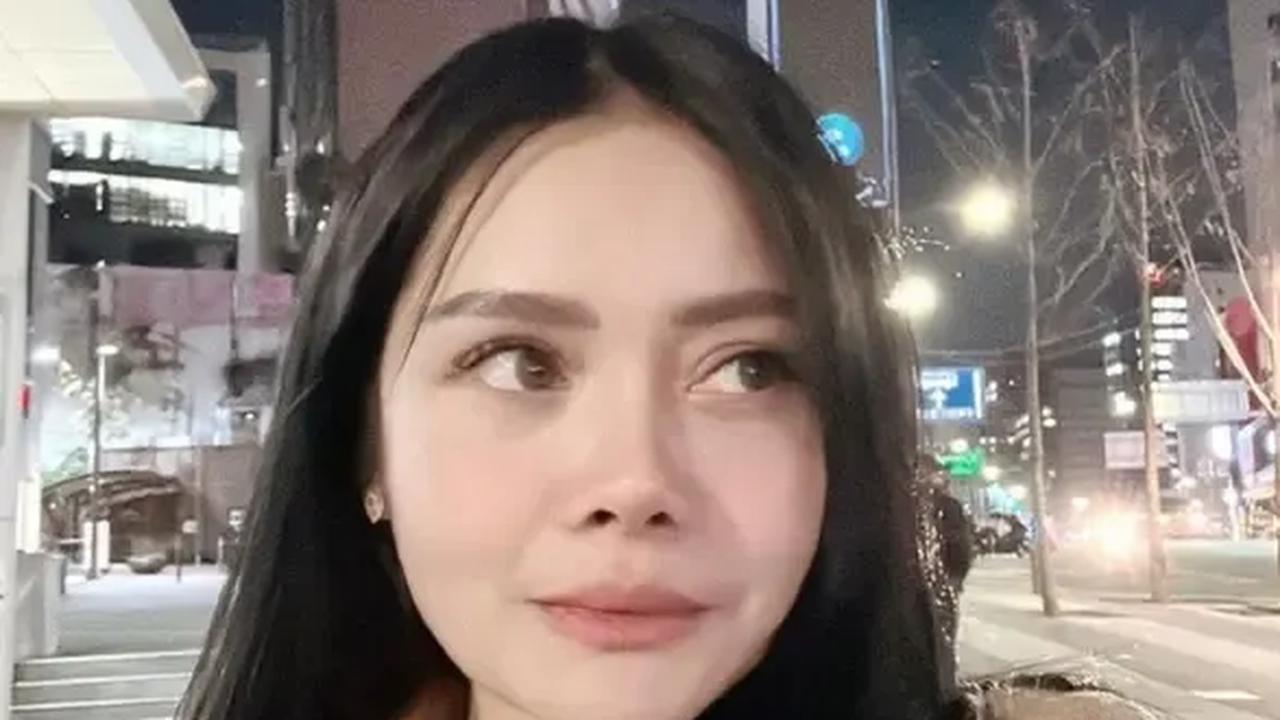 Mawar AFI Oplas Hidung Lagi Implan Pakai Tulang Iga, Ini Potretnya