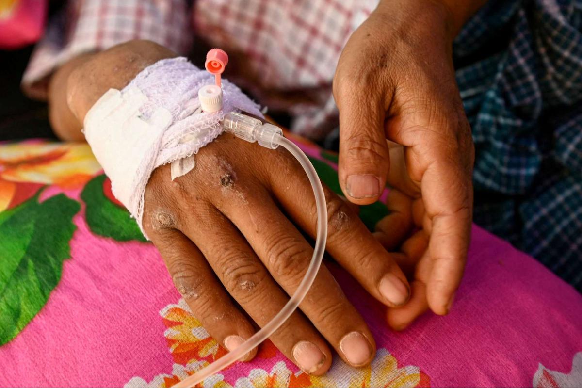 Pria Myanmar diselamatkan hidup-hidup setelah 5 hari tertimbun reruntuhan hotel akibat gempa