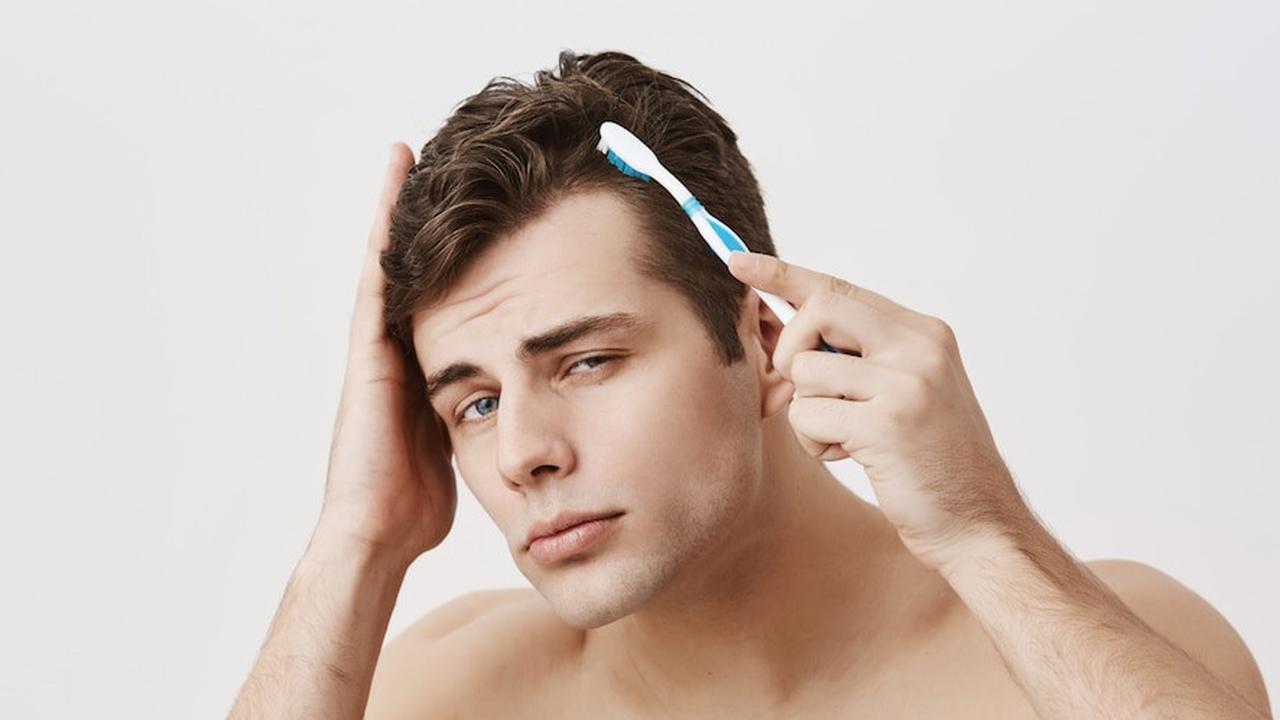 Cara Menumbuhkan Kembali Rambut yang Botak dan Pitak, Tidak Perlu Transplantasi hingga Turki