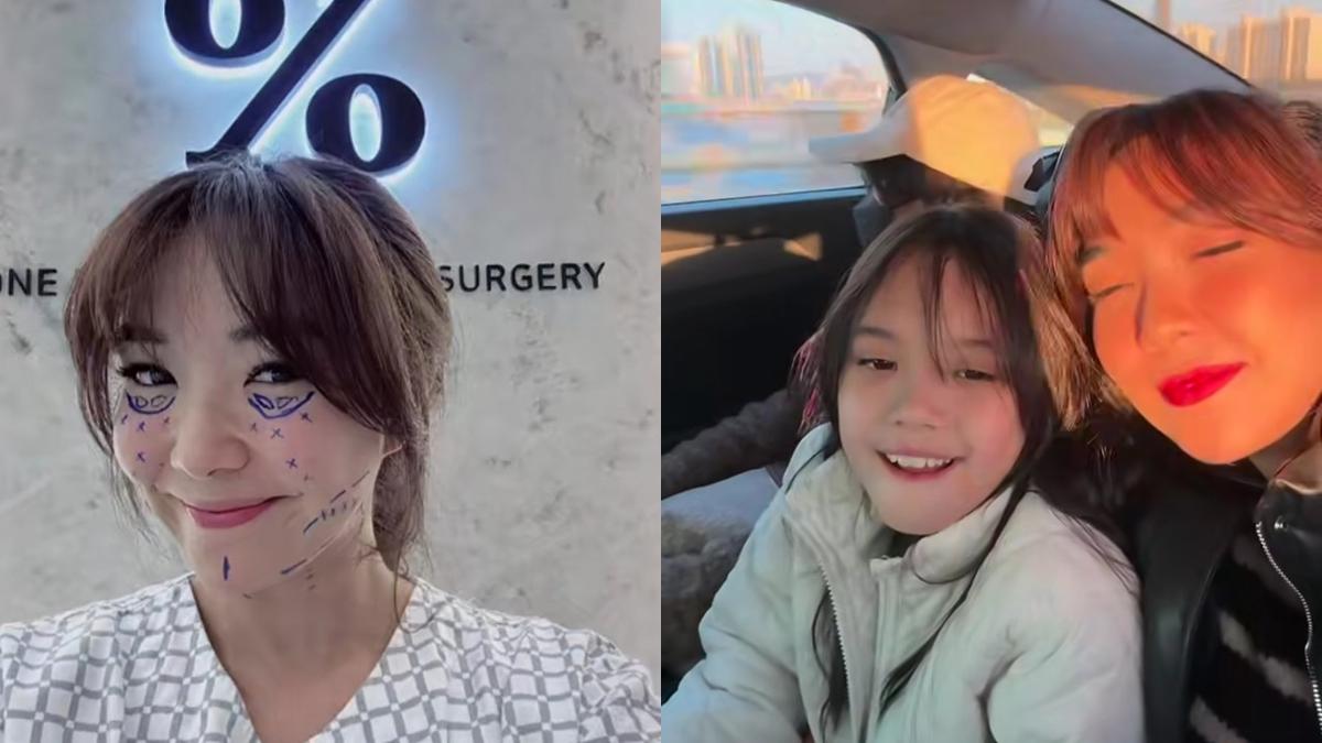 7 Potret Gisella Anastasia Lakukan Operasi Plastik di Korea, Ditemani Gempi