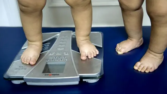 anak-obesitas-130910b.jpg
