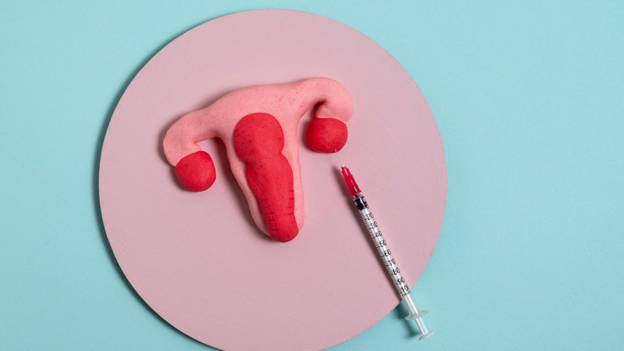 Jerawat Muncul Setelah Pasang IUD? Simak Penjelasan Ahli