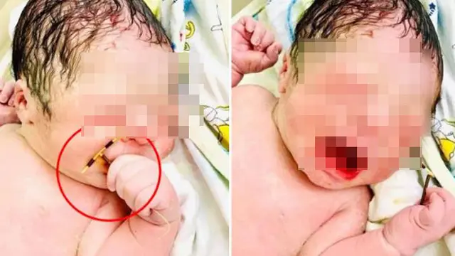 Viral Bayi Lahir Sambil Pegang Alat Kontrasepsi Ibunya