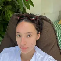 Tatjana Saphira Pede Pamer Wajah Berjerawat (Sumber: Instagram/tatjanasaphira)