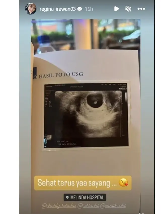 6 Potret Charly Van Houten Umumkan Sang Istri Hamil Anak Ketiga, Penuh Kebahagiaan