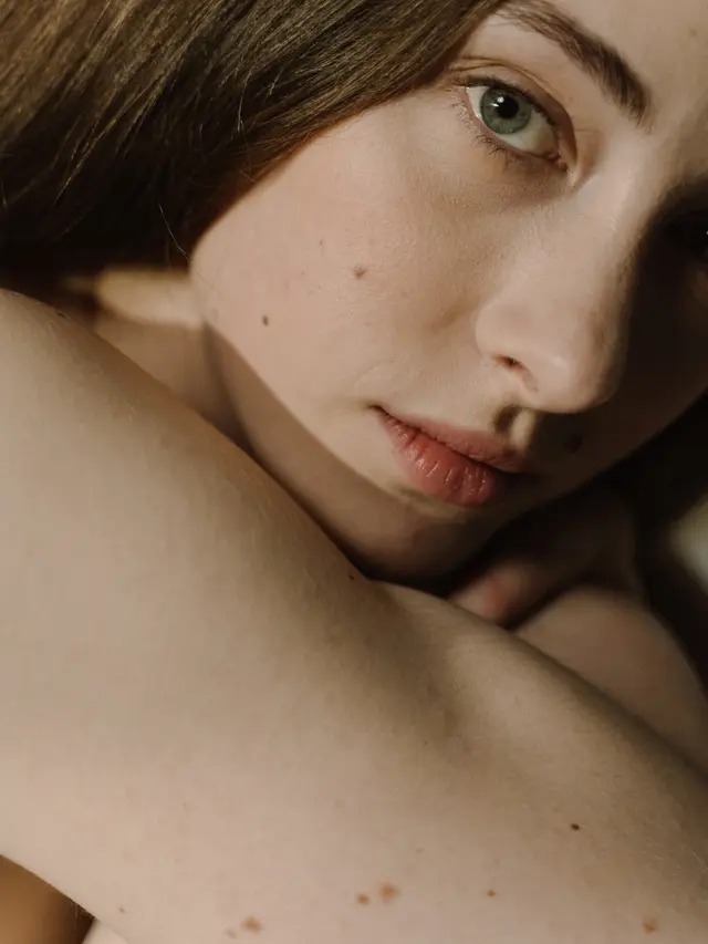 Ilustrasi Tahi Lalat