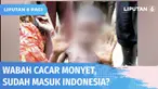 Saat ini masih banyak yang bertanya ‘apa itu cacar monyet?’ sebuah infeksi virus yang ditandai dengan bintil bernanah di kulit dan menimbulkan benjolan di leher akibat pembengkakan kelenjar getah bening. Seberapa bahaya cacar monyet? Apakah sudah...