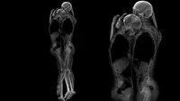 Kreatif! Seniman Ini Memotret Dengan Mesin X-ray