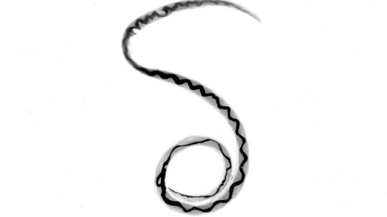 Angiostrongylus cantonensis